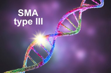 Spinal kas atrofisi, SMA, tip 3, SMN1 genindeki mutasyon, kavramsal 3D illüstrasyon nedeniyle motor nöron kaybı nedeniyle ilerleyen kas israfı ile genetik nöromusküler bozukluk.