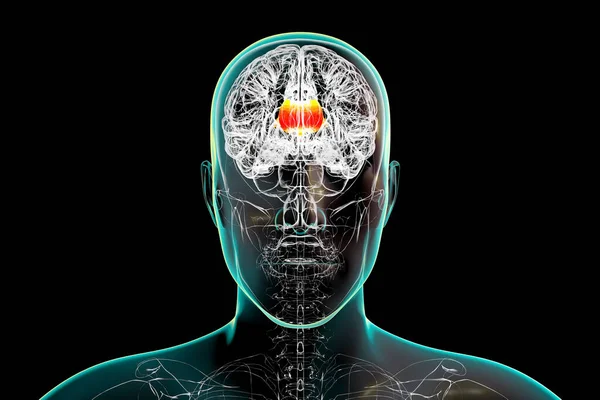 人間の脳で強調されている3次元イラストでは カロサムと呼ばれるコーパスが強調されています 左脳半球と右脳半球を結ぶ太い神経回路です — ストック写真