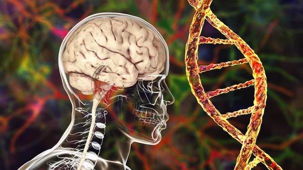 Genetic brain disorders, conceptual 3D illustration. Mutations in the DNA leading to brain diseases. Neurogenetics, neurodegenerative disorders