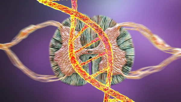 Doenças Genéticas Medula Espinhal Ilustração Conceitual Mutações Adn Que Levam — Fotografia de Stock