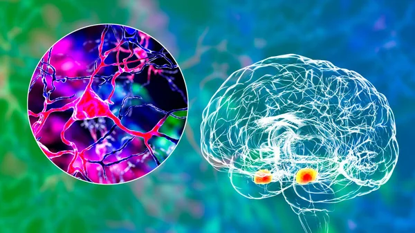 Amygdala Mózgu Zbliżenie Widok Neuronów Migdałowatych Ilustracja Dwa Migdałowe Skupiska — Zdjęcie stockowe