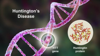 Huntington's chorea, a neurodegenerative disease due to a mutation in the huntingtin gene HTT, deficiency in the huntingtin protein and changes in brain basal ganglia, 3D illustration clipart