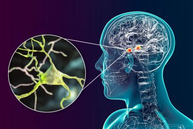 Amygdala in the brain, and closeup view of amygdala neurons, 3D illustration. Two almond-shaped clusters of nuclei within temporal lobes, part of the limbic system, play role in memory and emotions clipart