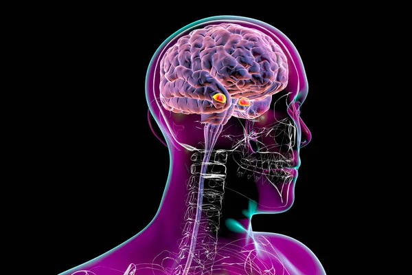 扁桃体としても知られる扁桃体は 脳内では3Dイラストとして知られています リンパ系の一部である側頭葉内の核の2つのアーモンド形のクラスターは 記憶と感情に役割を果たしている — ストック写真