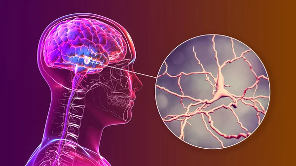 Black substance of the midbrain and its dopaminergic neurons, 3D illustration. Black substance regulates movement and reward, its degeneration is a key step in development of Parkinson\'s disease