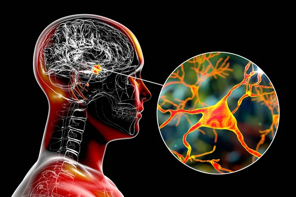 Amygdala Mózgu Zbliżenie Widok Neuronów Migdałowatych Ilustracja Dwa Migdałowe Skupiska — Zdjęcie stockowe