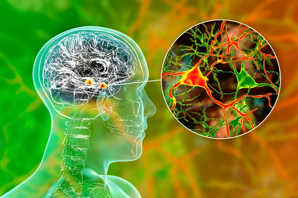 Amygdala in the brain, and closeup view of amygdala neurons, 3D illustration. Two almond-shaped clusters of nuclei within temporal lobes, part of the limbic system, play role in memory and emotions