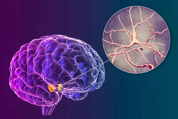 Black substance of the midbrain and its dopaminergic neurons, 3D illustration. Black substance regulates movement and reward, its degeneration is a key step in development of Parkinson\'s disease