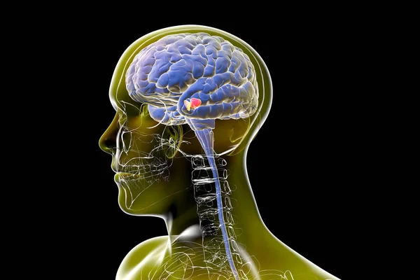 Black substance of the midbrain, 3D illustration. Black substance regulates movement and reward, its degeneration is a key step in development of Parkinson's disease