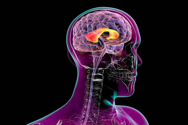 人間の脳で強調されている3次元イラストでは カロサムと呼ばれるコーパスが強調されています 左脳半球と右脳半球を結ぶ太い神経回路です — ストック写真