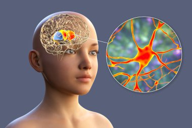Çocuğun beyninde dorsal striatum vurgulandı ve nöronların yakın görüntüsü, üç boyutlu illüstrasyon. Motor ve ödül sistemlerinin bir bileşeni olan bazal gangliyonun bir çekirdeği.