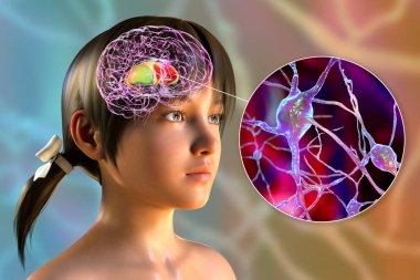 Çocuğun beyninde dorsal striatum vurgulandı ve nöronların yakın görüntüsü, üç boyutlu illüstrasyon. Motor ve ödül sistemlerinin bir bileşeni olan bazal gangliyonun bir çekirdeği.
