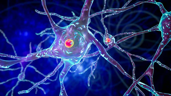 Nükleer Olmayan Nöronlar Dahil Boyutlu Çizimler Nöronlarda Huntingon Hastalığı Spinoserebellar — Stok fotoğraf