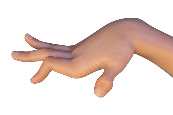 Die Hand Eines Kindes Mit Chorea Einer Hyperkinetischen Bewegungsstörung Illustration — Stockfoto