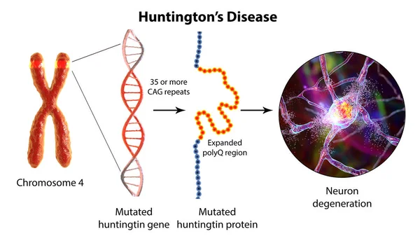 亨廷顿病的分子起源 3D图解 在Htt基因中Cag三核苷酸序列的扩展会导致Huntingtin突变蛋白的产生 导致神经变性 — 图库照片