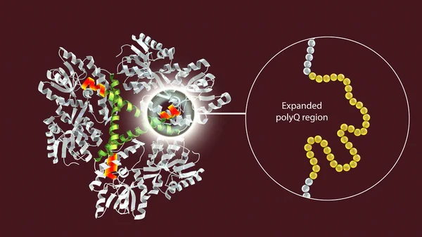 Molecule of the mutant Huntingtin protein, the cause of Huntington's disease, 3D illustration. It contains polyglutamine expansion (polyQ, marked orange, shown closeup on the left)