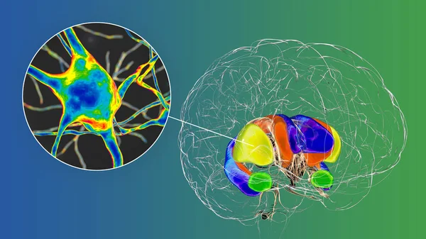 Dorsal Striatum Highlighted Brain Its Neurons Illustration Dorsal Striatum Consists — Stock Photo, Image