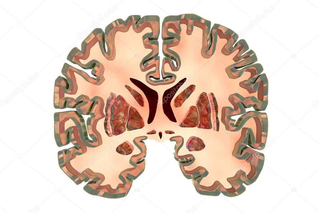 Coronal section of a healthy brain showing normal anatomy of basal baglia and ventricles, 3D illustration