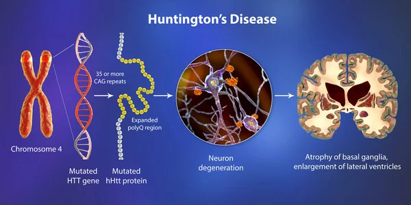 亨廷顿病的分子起源 3D图解 在Htt基因中Cag三核苷酸序列的扩展会导致Huntingtin突变蛋白的产生 导致神经变性 — 图库照片