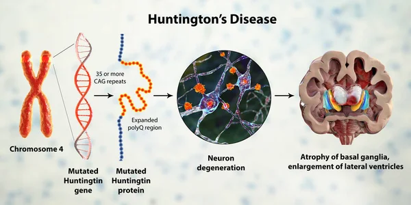 Huntington Hastalığının Moleküler Oluşumu Boyutlu Illüstrasyon Htt Genindeki Cag Trinükleotid — Stok fotoğraf