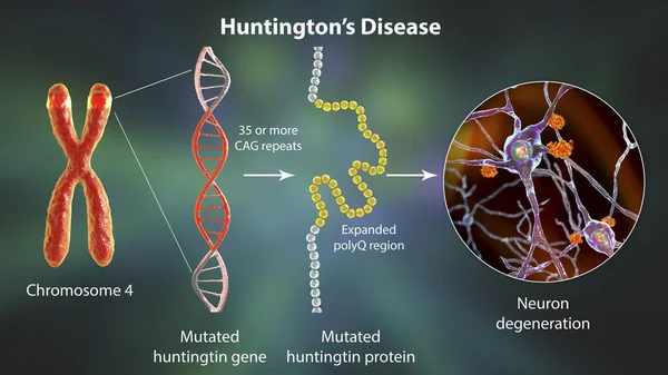 헌팅턴 유전자 Cag 트라이 뉴클레오타이드 서열의 확장은 퇴화를 유발하는 돌연변이된 — 스톡 사진