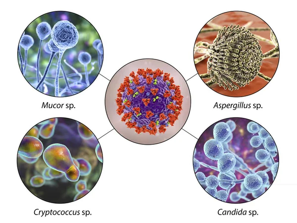 Fungal Complications Covid Illustration Covid Associated Mycoses Mucor Aspergillus Cryptococcus — Stock Photo, Image