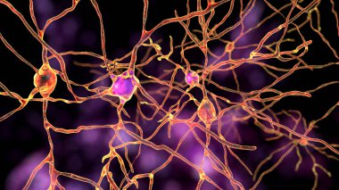 Dorsal striatum nöronları, 3 boyutlu illüstrasyon. Sırt striatumu bazal gangliyonda bir çekirdektir. Nöronların bozulması Huntington hastalığının gelişiminde çok önemli bir rol oynar.