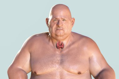 Thyroid gland highlighted in obese man, 3D illustration. Concept of obesity and inner organs disease. Thyroid autoimmunity and hypothyroidism. clipart