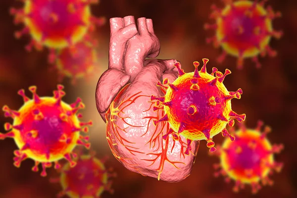 COVID-19 viruses affecting the heart, conceptual 3D illustration. Heart complications associated with COVID-19 coronavirus disease. The negative effect of SARS-CoV-2 virus on the human heart.