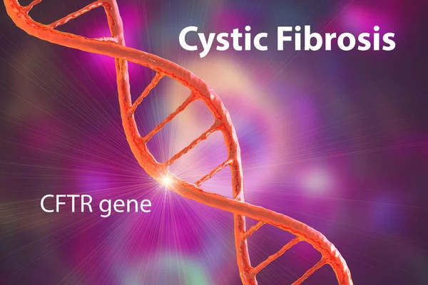 Cystic fibrosis, a genetic disorder caused by mutation in the CFTR gene, inherited in an autosomal recessive manner, that affects lungs, pancreas and other organs, conceptual 3D illustration