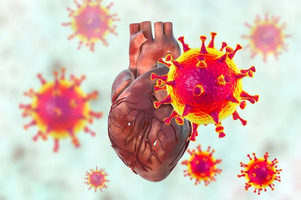 COVID-19 viruses affecting the heart, conceptual 3D illustration. Heart complications associated with COVID-19 coronavirus disease. The negative effect of SARS-CoV-2 virus on the human heart.