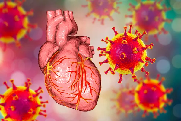 COVID-19 viruses affecting the heart, conceptual 3D illustration. Heart complications associated with COVID-19 coronavirus disease. The negative effect of SARS-CoV-2 virus on the human heart.