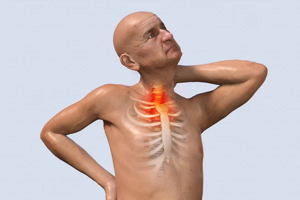 Spine pain, neck pain. X-ray of the human skeleton. Anatomy of male body. 3d medical illustration. A senior man with painful back and highlighted skeleton. Front view