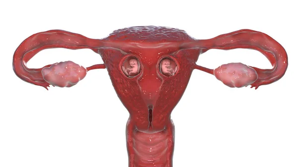 Foetus Jumeaux Intérieur Utérus Féminin Illustration Semaine — Photo