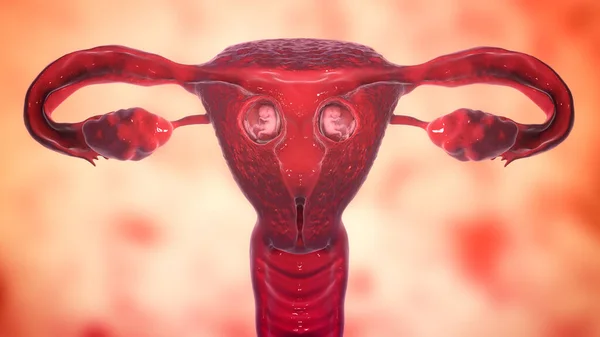 Fetos Gêmeos Dentro Útero Feminino Ilustração Semana — Fotografia de Stock