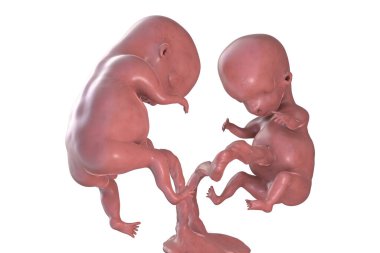 Tek plasentalı ikiz embriyolar, 3 boyutlu illüstrasyon. Erken fetal dönem, 8 - 16 hafta
