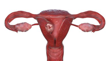 Rahimde tek yumurta ikizleri, tek plasenta, üç boyutlu illüstrasyon. Erken fetal dönem, 8 - 16 hafta