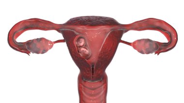 Bir akorlu ve iki amniyonlu tekli ikizler, üç boyutlu illüstrasyon. 8 haftalık insan fetüsü.
