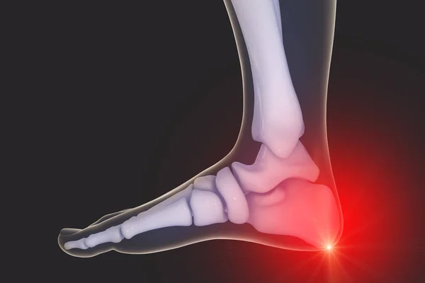 Ayak Ayak Bileği Ağrısı Boyutlu Illüstrasyon Ayak Anatomisi Topuk Dürtüsü — Stok fotoğraf