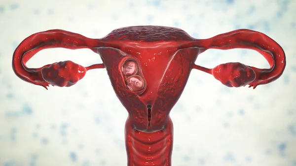 Monozygotická Dvojčata Děloze Jedním Sborem Dvěma Amniony Ilustrace Lidské Embryo — Stock fotografie