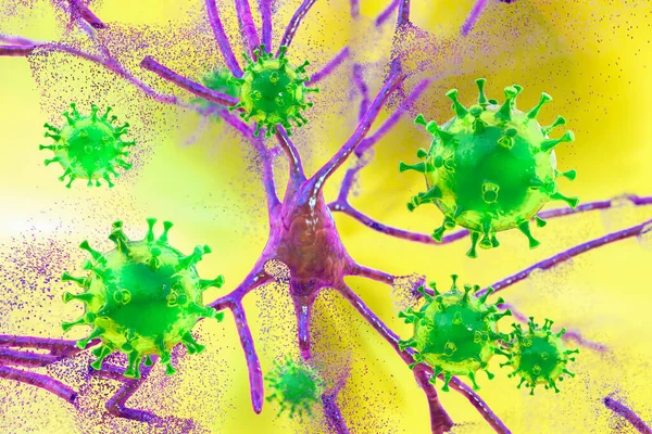 Virus Infectando Neuronas Destrucción Neuronal Concepto Para Infección Cerebral Ilustración — Foto de Stock