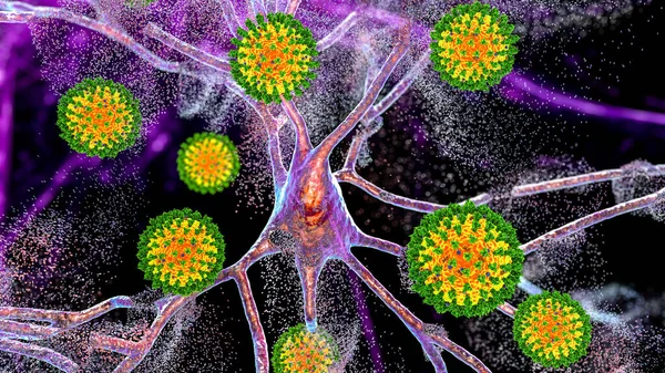 Coronavirus Destrucción Neuronas Ilustración Conceptual Trastornos Del Olfato Del Gusto — Foto de Stock
