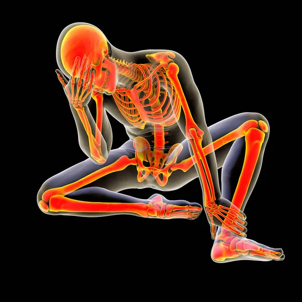 男性的骨骼在不快乐的沮丧的姿势 概念三维插图 身体中痛苦的感觉 坏的感觉 压力的概念 — 图库照片