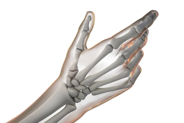 Menschliche Hand Und Arm Mit Skelettknochen Illustration — Stockfoto