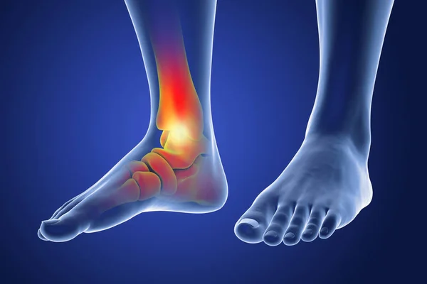 Πόνος Στο Πόδι Και Στον Αστράγαλο Τρισδιάστατη Απεικόνιση Ανατομία Ποδιών — Φωτογραφία Αρχείου