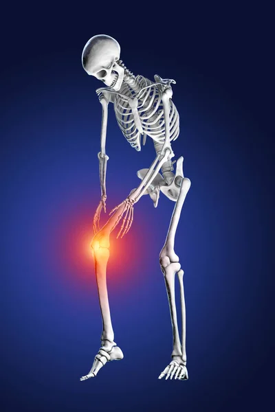 Pijnlijke Knie Anatomie Geneeskunde Concept Illustratie — Stockfoto