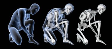 Ayak ve ayak bileği ağrısı, kavramsal 3 boyutlu illüstrasyon. İnsan anatomisi. Poz vermiş bir erkek vücudu ayak ağrısını gösteriyor, iskeleti çizilmiş ve izole edilmiş.