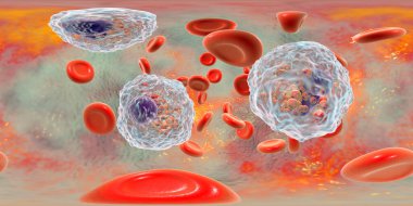 360-degree spherical panorama of blood with eosinophilia showing multiple eosinophils surrounded by red blood cells, 3D illustration clipart