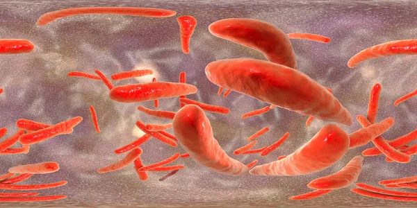 360 Graden Bolvormig Panorama Van Bacteriën Mycobacterium Tuberculosis Andere Mycobacteriën — Stockfoto