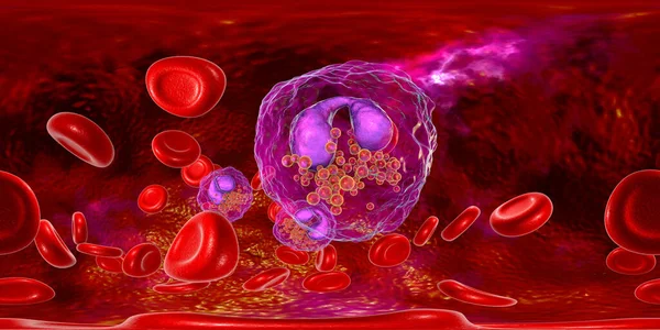 赤血球に囲まれた複数の好酸球を示す好酸球症と血液の360度球面パノラマ 3Dイラスト — ストック写真